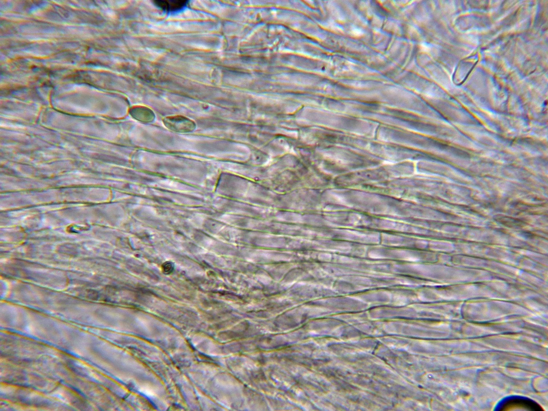 Microscopía de Tephrocybe rancida - 7 - Suprapellis agua-001